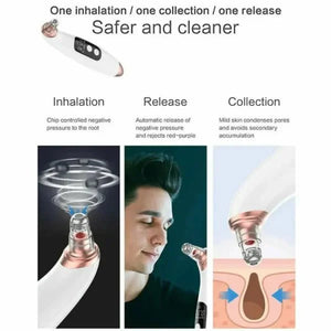 Electric Blackhead Remover Facial Cleansing Pore Vacuum - DiscountsHub